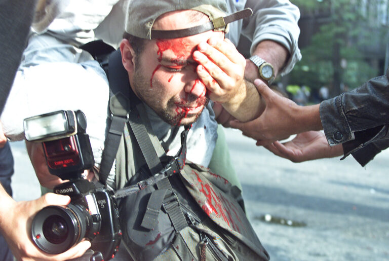 Sindicato assina carta-aberta pela reparação do fotojornalista Alex Silveira