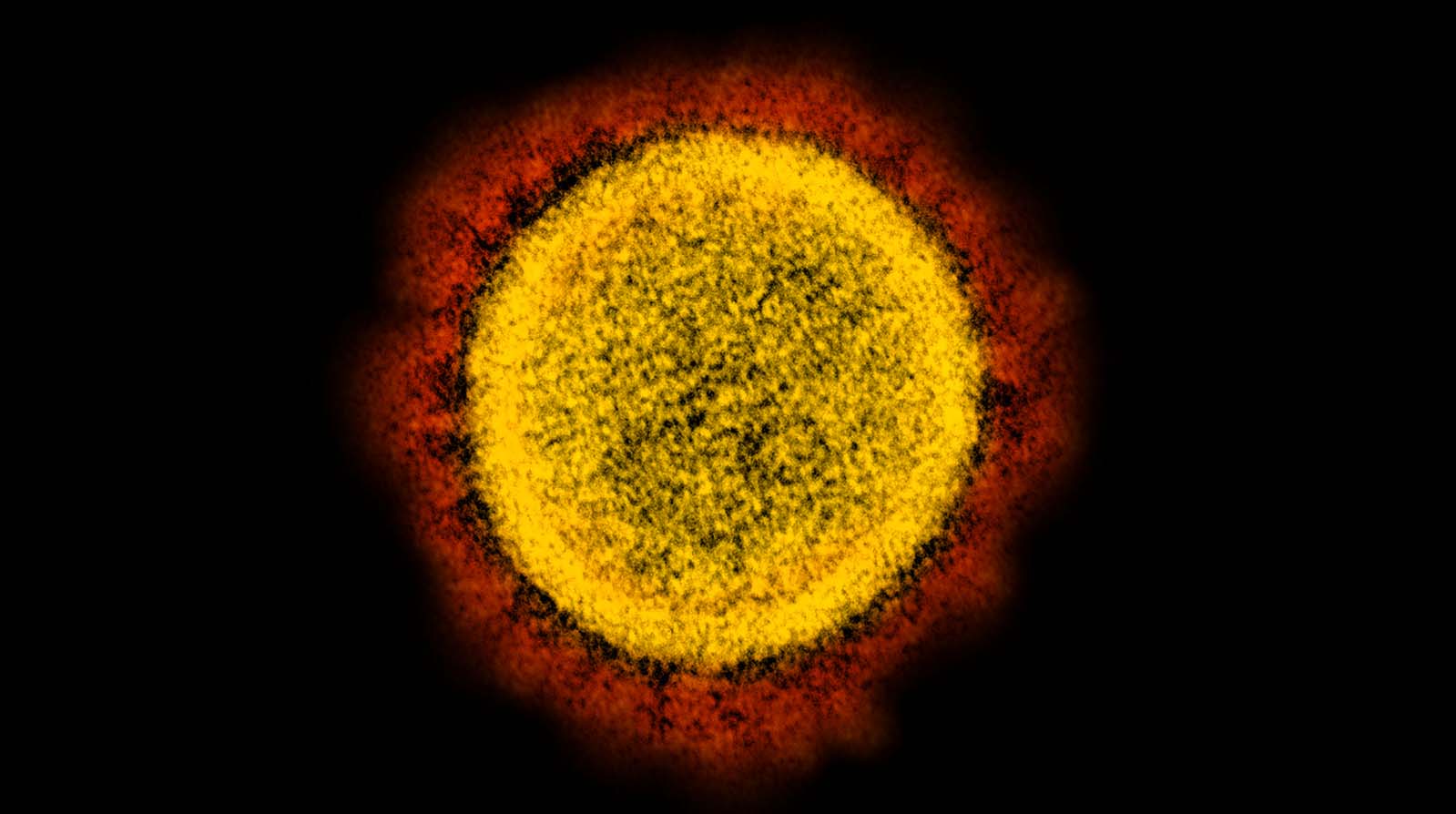 Sindicato solicita inclusão de jornalistas entre os grupos prioritários de vacinação contra covid-19