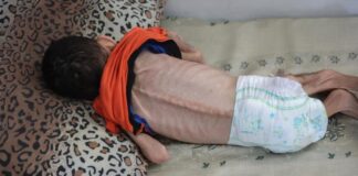 Agência France Press denuncia ao mundo que seus dez jornalistas de Gaza estão quase morrendo de fome: “É a maior vergonha de nossa geração” Criança palestina Jawad Al-Anqar morreu em Gaza por desnutrição, no último sábado (19/7), conforme fonte do Hospital Al-Shifa (Palestine International Broadcast)