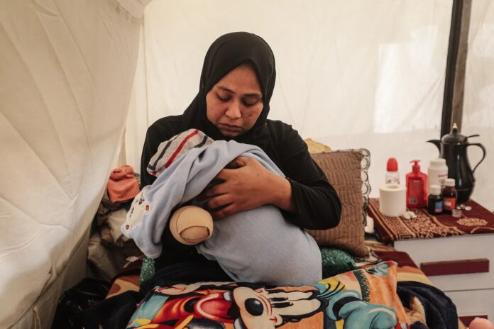 Samah Afane, que perdeu a mão direita e sofreu graves ferimentos no pé em ataques israelenses em Gaza, alimenta filho recém-nascido em 24/1/2026 (foto: Moiz Salhi/Anadolu)