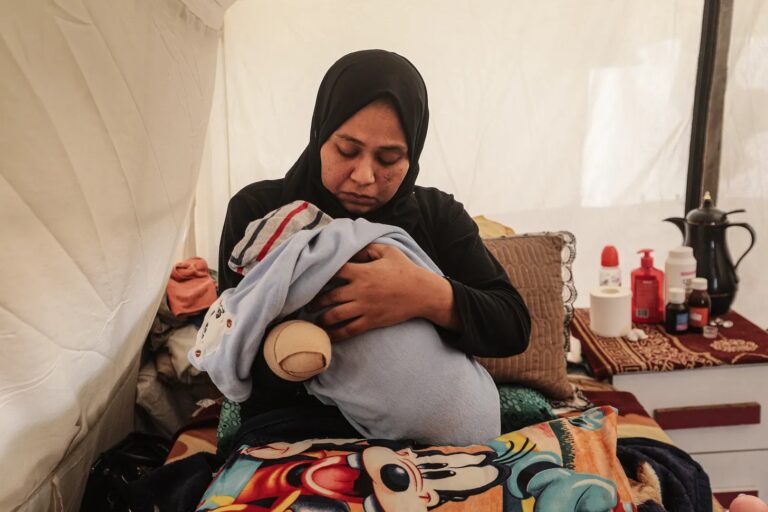 Samah Afane, que perdeu a mão direita e sofreu graves ferimentos no pé em ataques israelenses em Gaza, alimenta filho recém-nascido em 24/1/2026 (foto: Moiz Salhi/Anadolu)